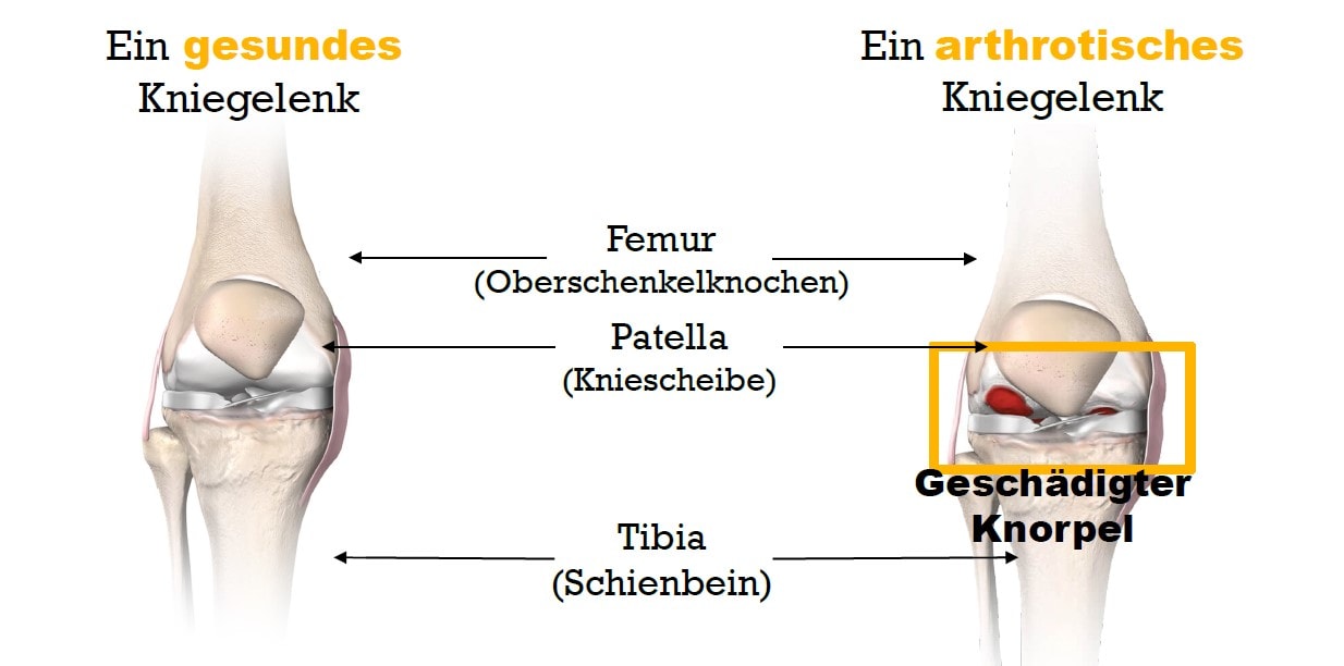 Grafik Knieanatomie Stryker